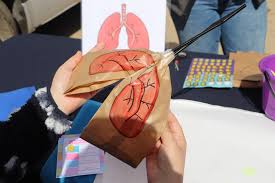 Tuberculosis en Coquimbo: advierten aumento de casos y refuerzan llamado a la detección temprana